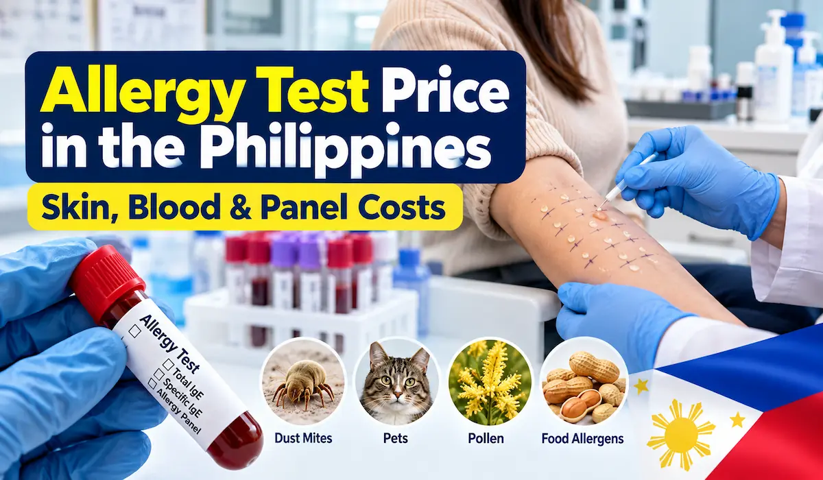 Allergy skin prick and blood test price guide in the Philippines