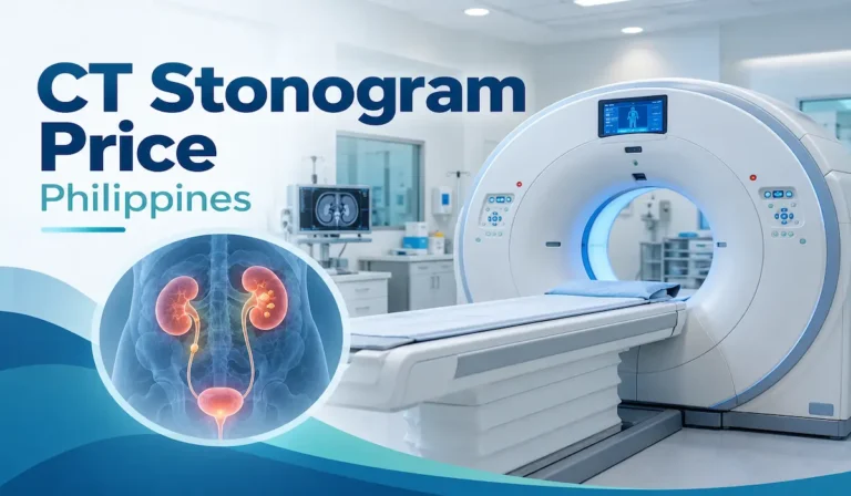 CT stonogram scanner with kidney stone illustration showing urinary tract imaging for CT stonogram price in the Philippines.