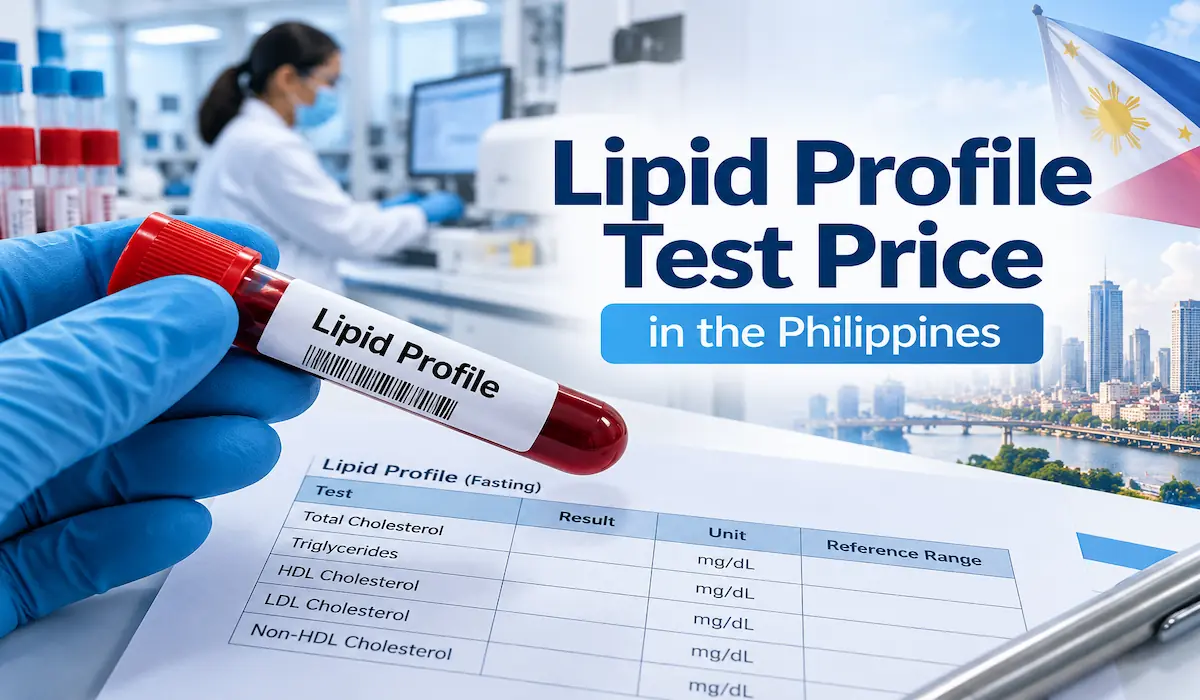 Lipid profile blood test sample and cholesterol test report showing HDL, LDL, and triglycerides at a diagnostic laboratory in the Philippines.